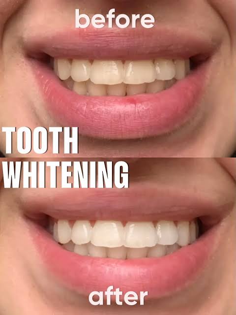 MARVIS Toothpaste